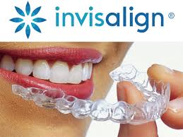 Align technology orthodontics